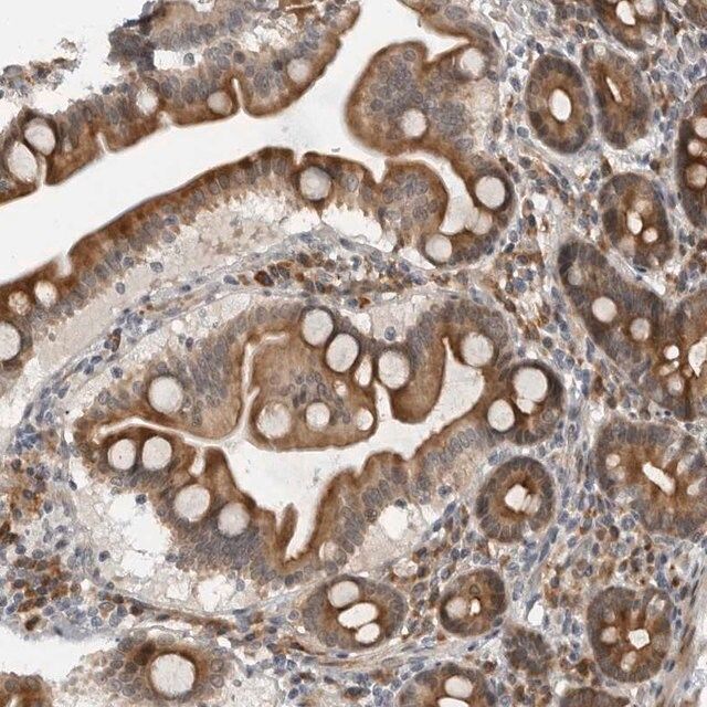 Anti-ALPK2 antibody produced in rabbit