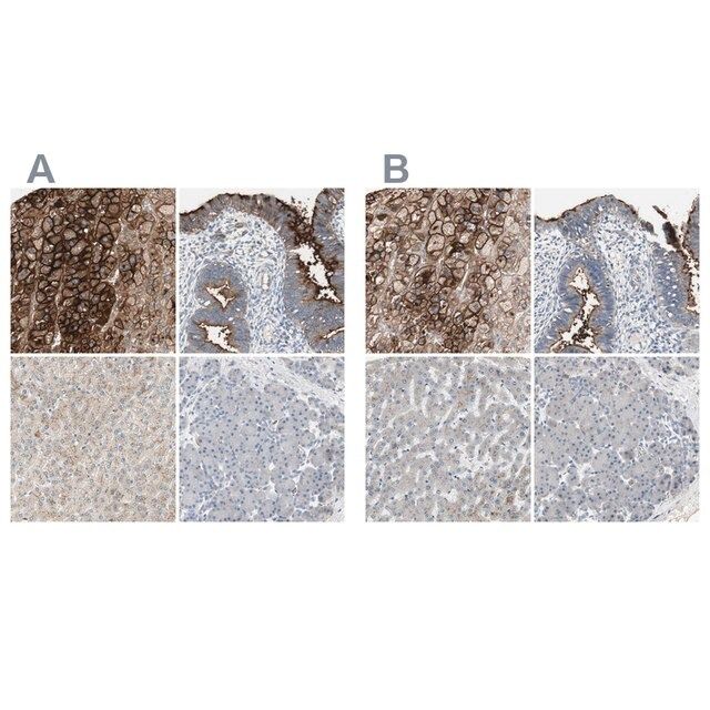 Anti-ALPL antibody produced in rabbit