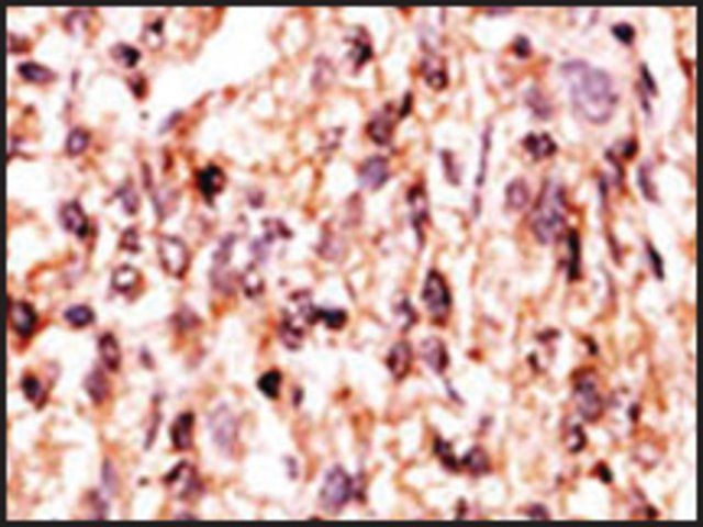 Anti-ALPK1 (N-term) antibody produced in rabbit