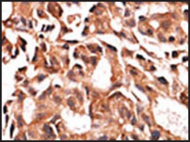 Anti-ALPK1 (C-term) antibody produced in rabbit