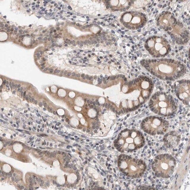 Anti-ALPK2 antibody produced in rabbit