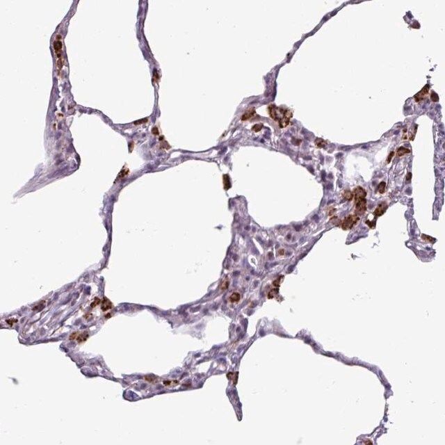 Anti-AMIGO2 antibody produced in rabbit