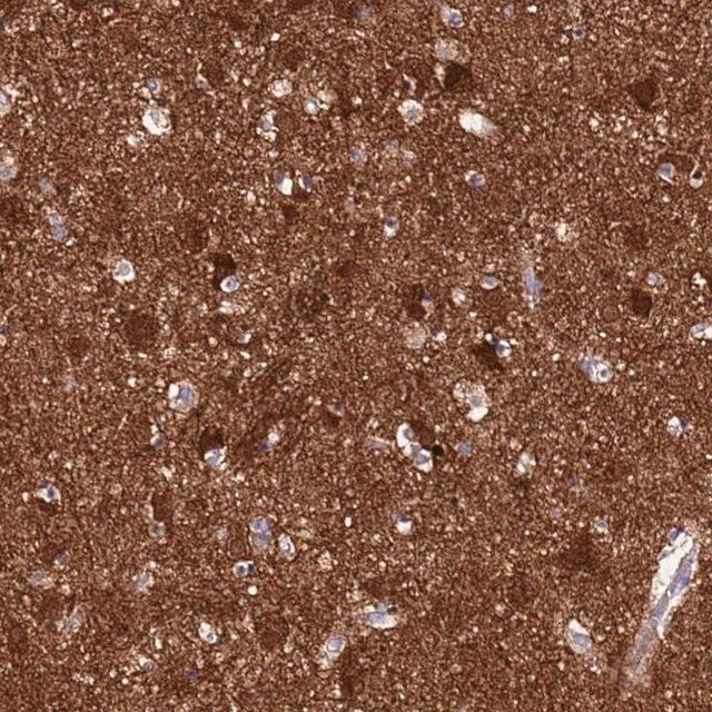 Anti-AMN1 antibody produced in rabbit