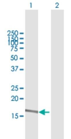 Anti-A2ML1 antibody produced in mouse
