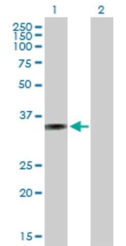Anti-AMMECR1 antibody produced in mouse