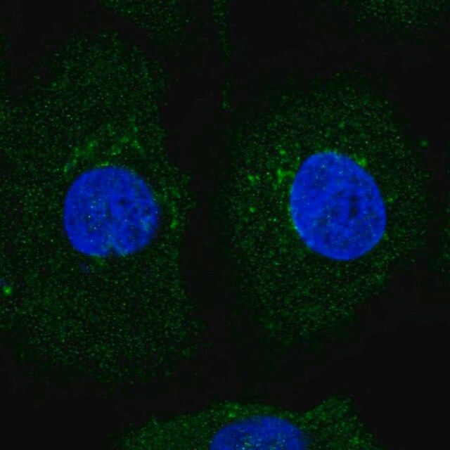 Anti-AMIGO2 antibody produced in rabbit