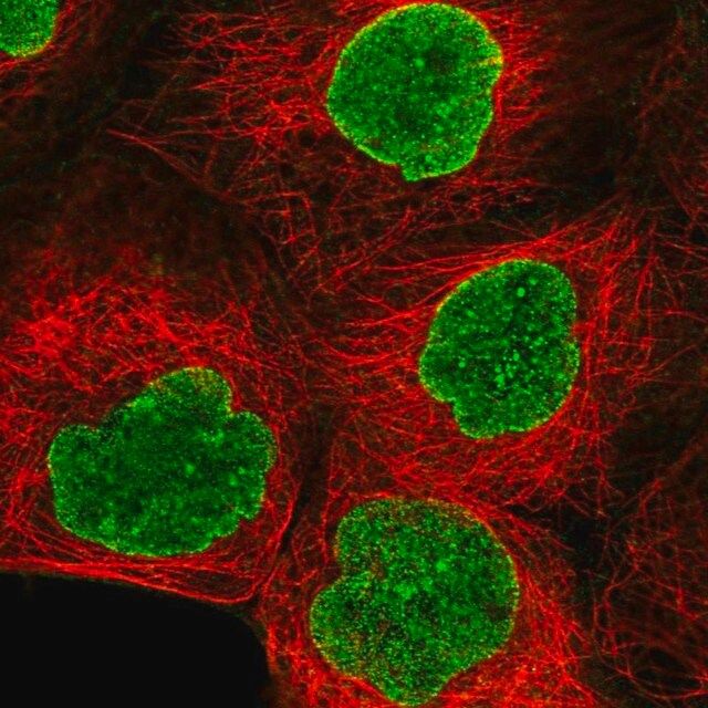Anti-AMPD3 antibody produced in rabbit