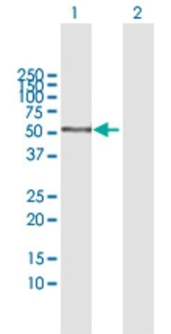 Anti-AMY1C antibody produced in mouse