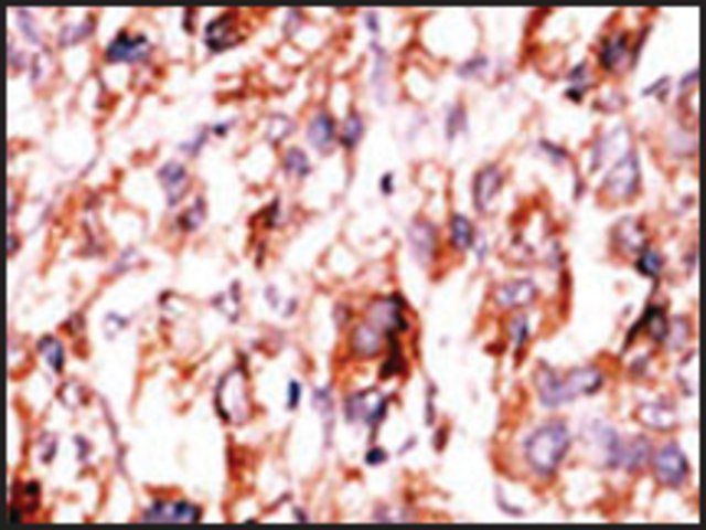 Anti-ADCK5 (C-term) antibody produced in rabbit