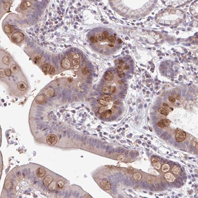 Anti-ADAT3 antibody produced in rabbit