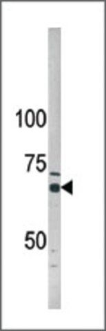 Anti-ADCK5 (N-term) antibody produced in rabbit