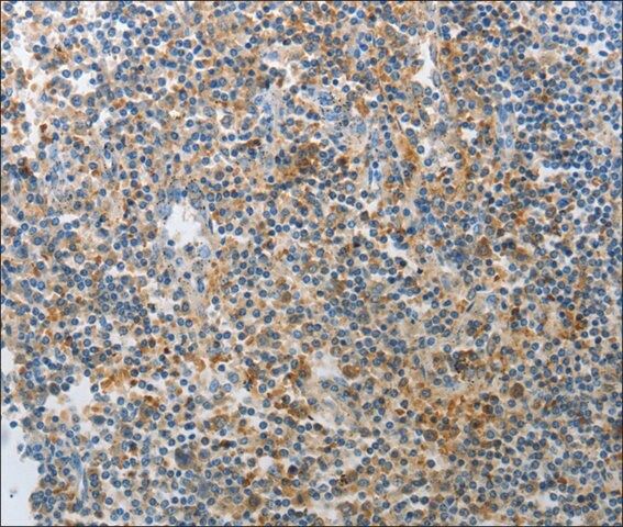 Anti-AD7C-NTP antibody produced in rabbit