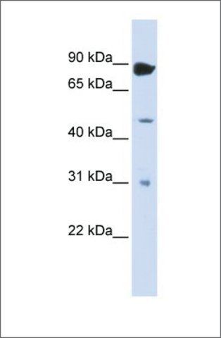Anti-ADARB1 antibody produced in rabbit