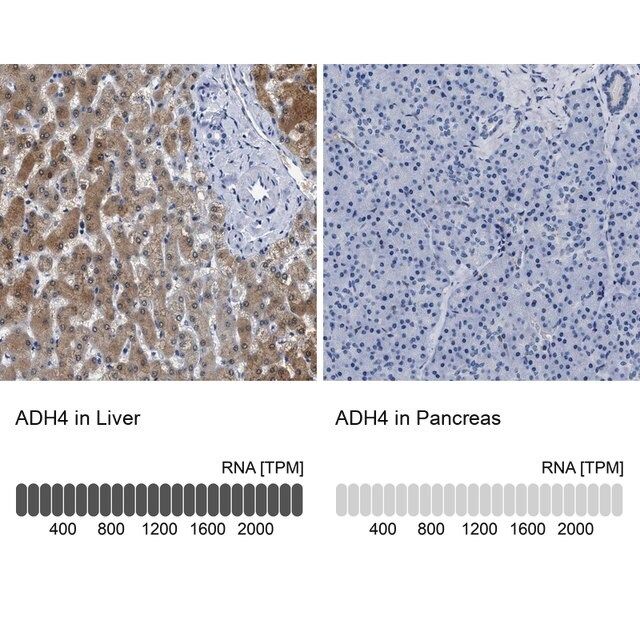 Anti-ADH4 antibody produced in rabbit