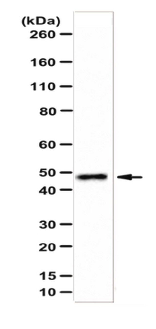 Anti-ADE2 Antibody/SAICAR synthetase