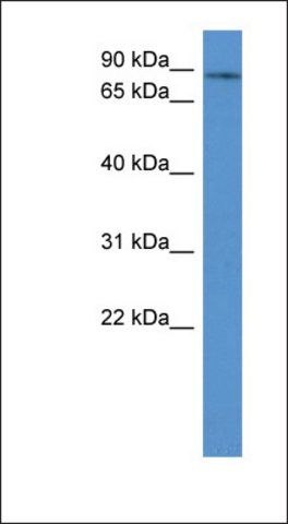 Anti-ADD3 antibody produced in rabbit