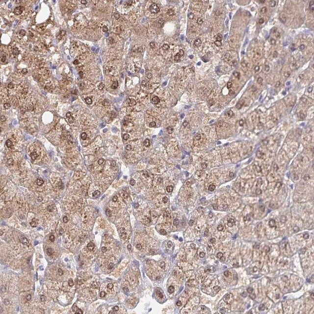 Anti-ADH1A antibody produced in rabbit