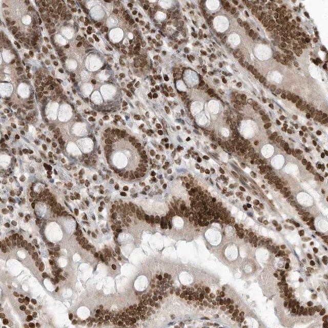 Anti-ADI1 antibody produced in rabbit