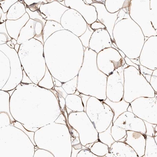 Anti-ADIRF antibody produced in rabbit