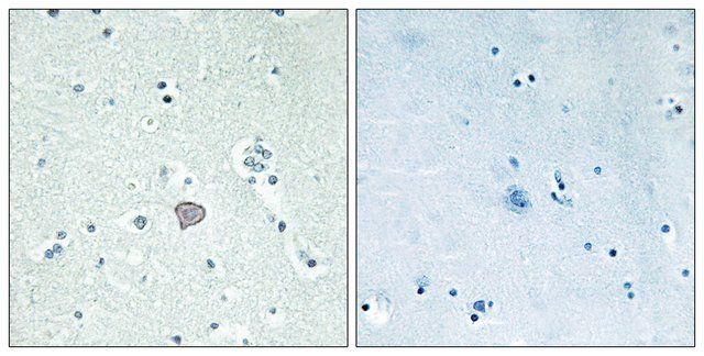 Anti-ADORA2A antibody produced in rabbit