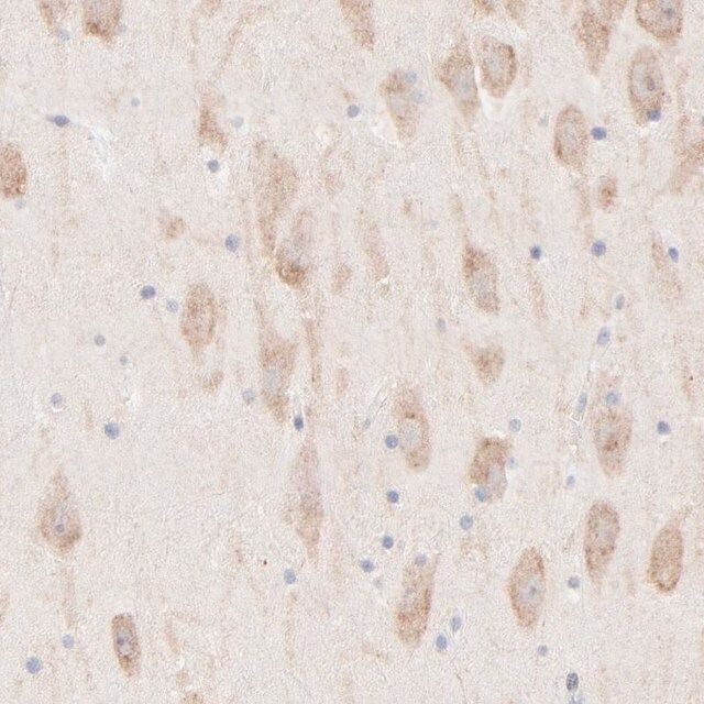Anti-AFF2 antibody produced in rabbit