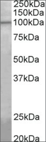Anti-Agbl5 antibody produced in goat