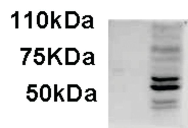 Anti-AIM2 (C-terminal) antibody produced in goat