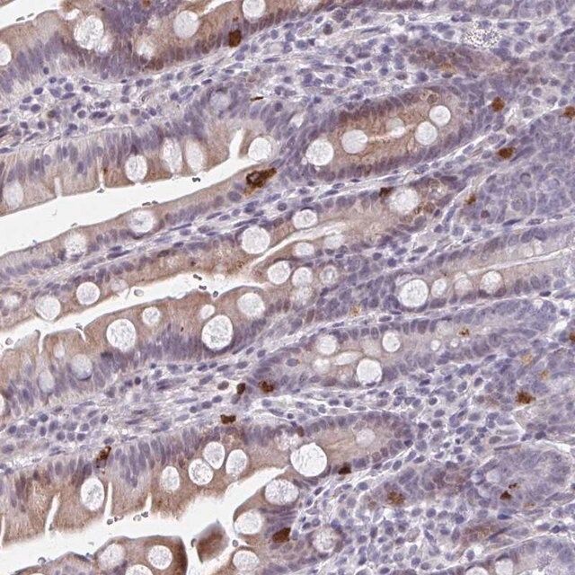 Anti-ABHD16B antibody produced in rabbit