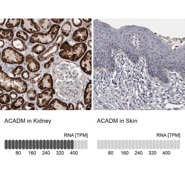 Anti-ACADM antibody produced in rabbit