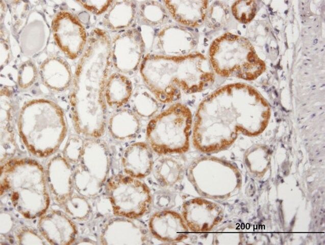 Anti-ACADM antibody produced in mouse