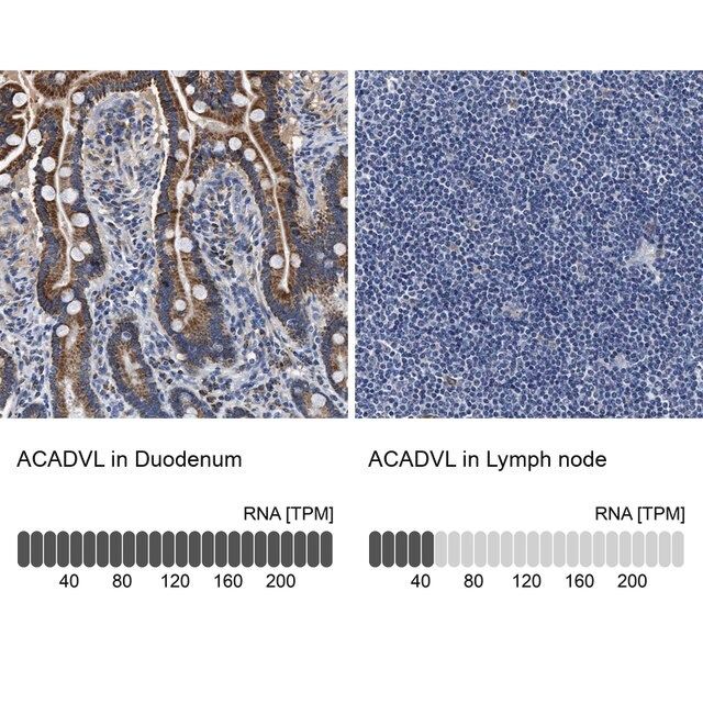 Anti-ACADVL antibody produced in rabbit