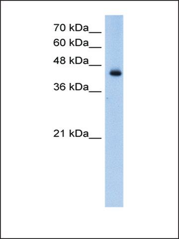 Anti-ACADL antibody produced in rabbit