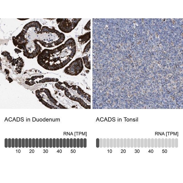 Anti-ACADS antibody produced in rabbit