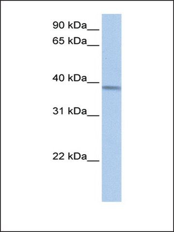 Anti-ACADSB antibody produced in rabbit