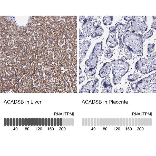 Anti-ACADSB antibody produced in rabbit