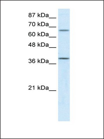 Anti-ACADM antibody produced in rabbit