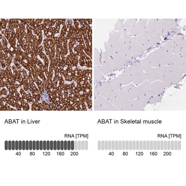 Anti-ABAT antibody produced in rabbit