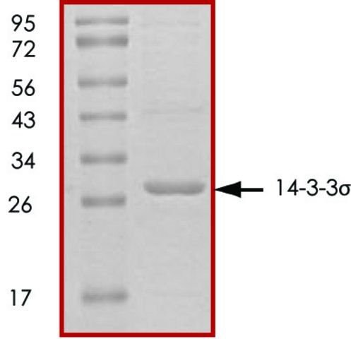 14-3-3 σ, untagged human