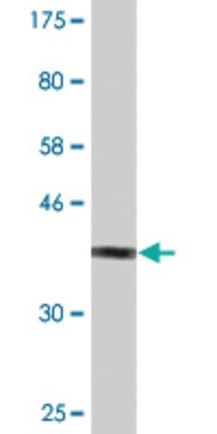 Monoclonal Anti-TSC2 antibody produced in mouse