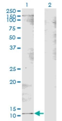 Monoclonal Anti-B2M antibody produced in mouse