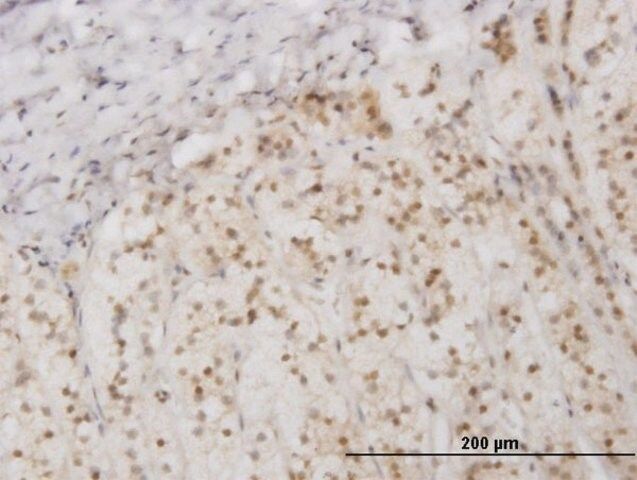 Monoclonal Anti-EIF2AK2, (N-terminal) antibody produced in mouse