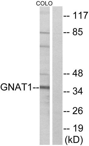 Anti-GNAT1 antibody produced in rabbit