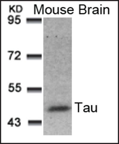 Anti-MAPT (Ab-181) antibody produced in rabbit