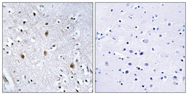 Anti-IRS-1 antibody produced in rabbit