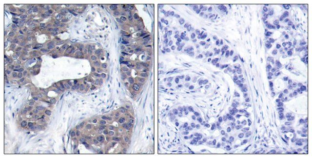 Anti-IRS-1 antibody produced in rabbit