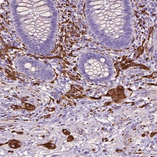 Anti-MAPT antibody produced in rabbit