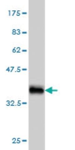 Monoclonal Anti-LRP5 antibody produced in mouse