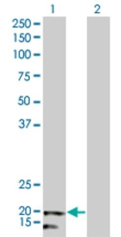 Monoclonal Anti-NDUFB5 antibody produced in mouse