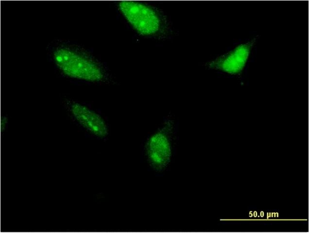 Monoclonal Anti-LOC285498 antibody produced in mouse