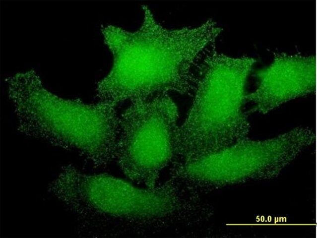 Monoclonal Anti-SMG1 antibody produced in mouse